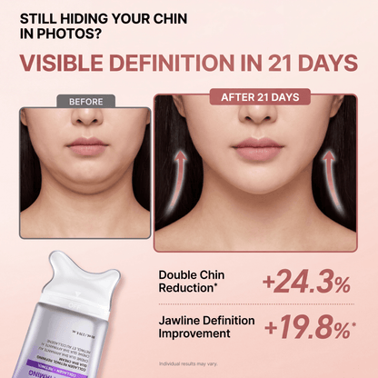 Luvix™ ChinSculpt 2.0